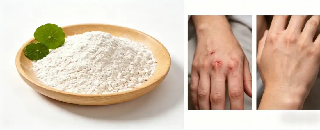 Gotu Kola Leaf Extract's Wound Healing Properties Gotu Kola Leaf Extract's Wound Healing Properties